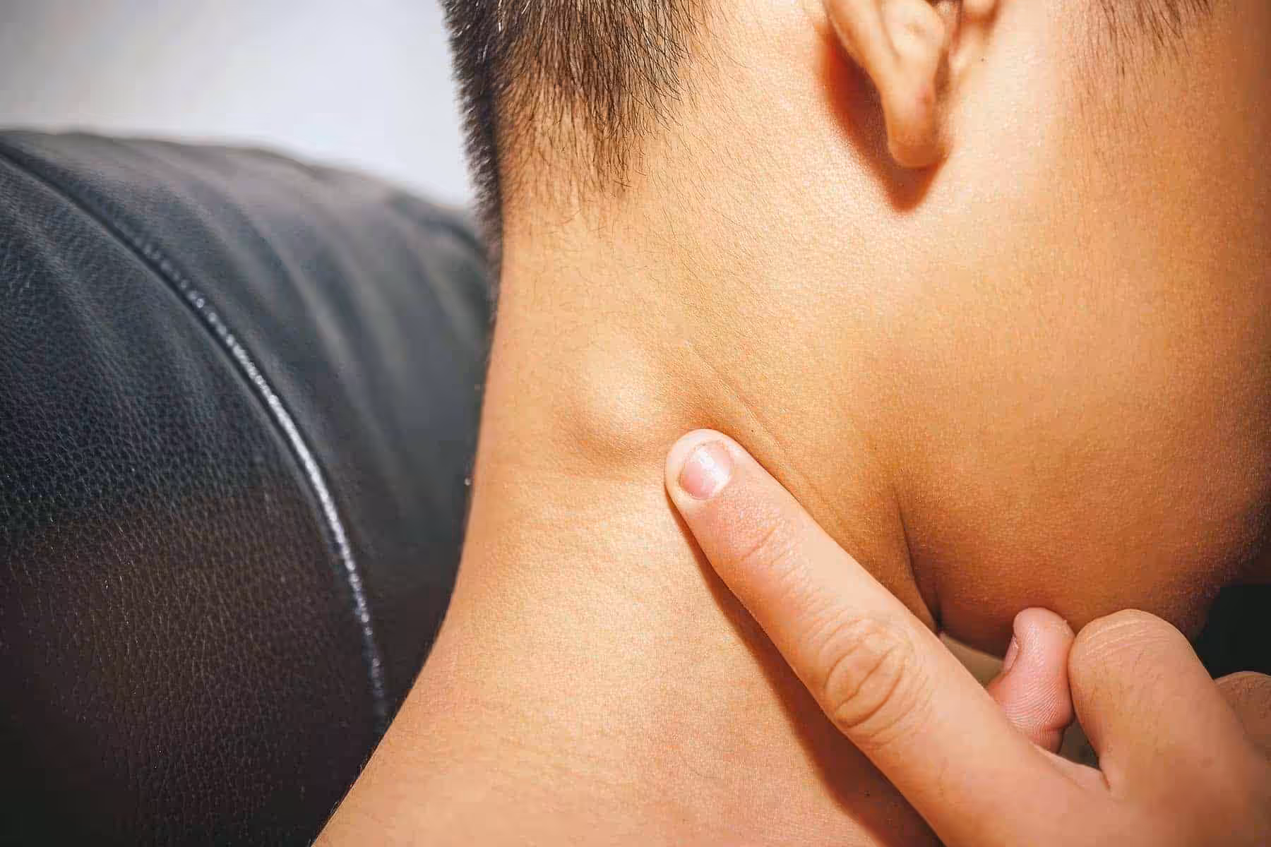 Lenf Bezi Büyümesi